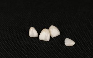 cleveland dental crowns