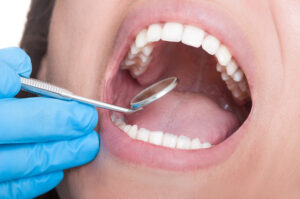 cleveland dental checkup