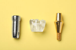 cleveland dental implants