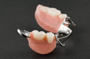 cleveland partial dentures