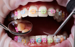 cleveland orthodontics