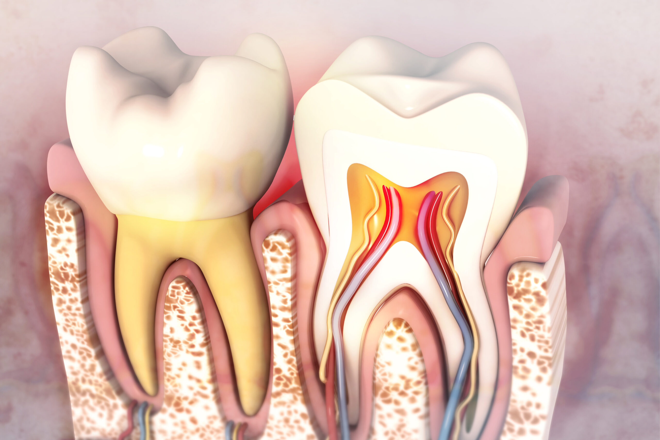 cleveland root canals