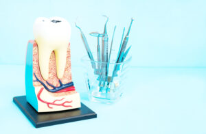 cleveland root canal treatment