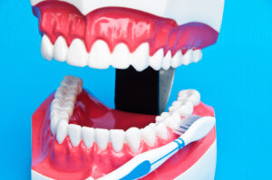 cleveland dental cleaning